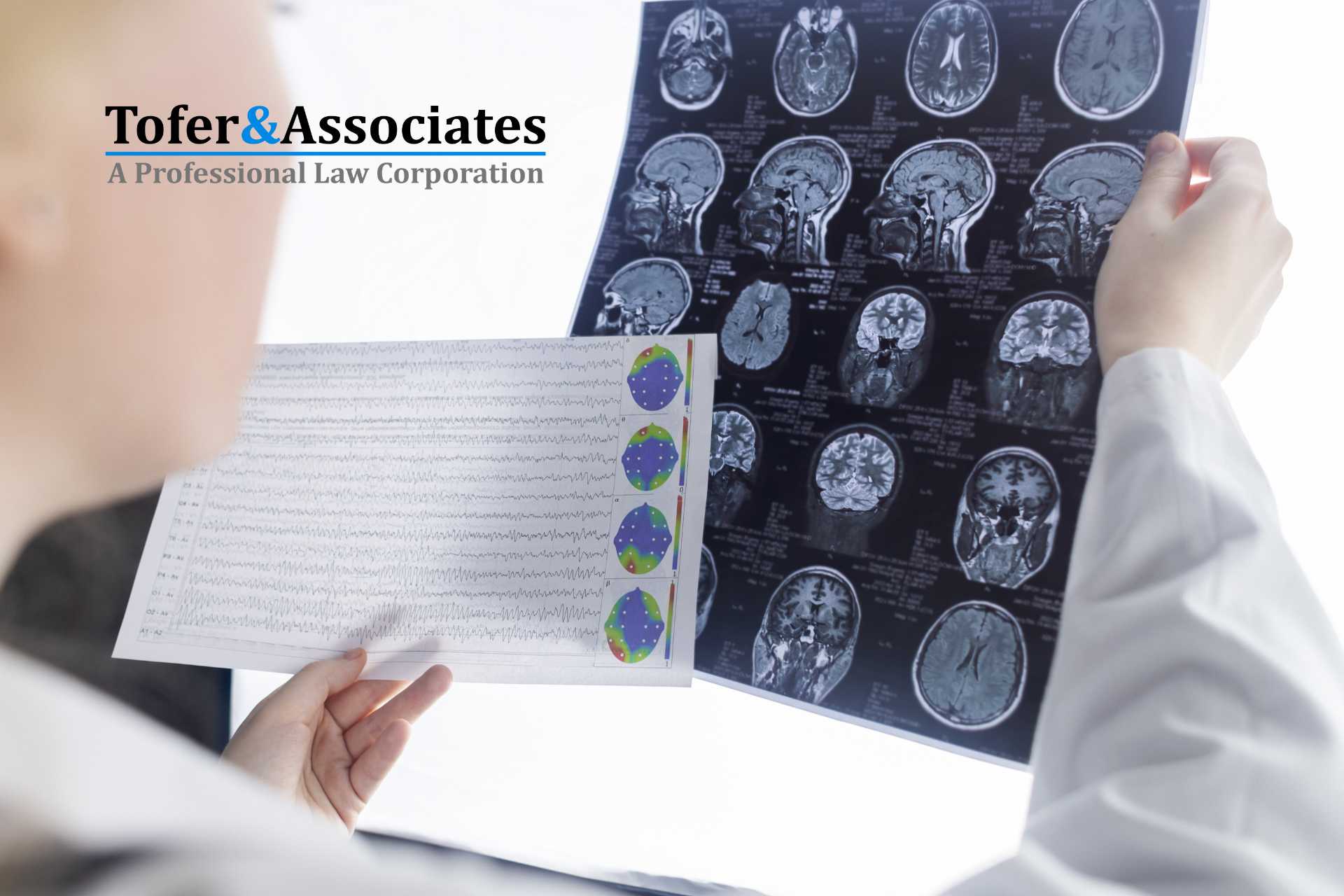 traumatic brain injury california