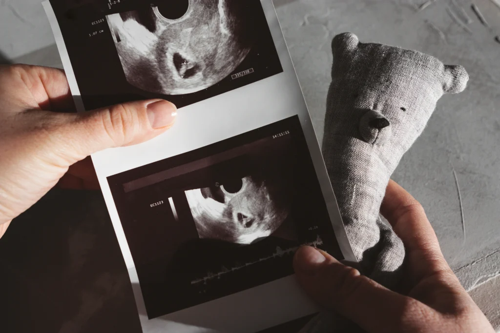 A hand holds ultrasound images of a fetus alongside a soft, gray teddy bear, symbolizing hope and anticipation.